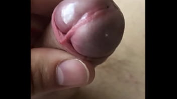 leeding penis