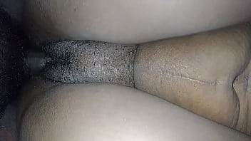 lysa gap prolapse