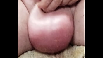 saline injection cbt
