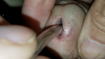 inside bladder