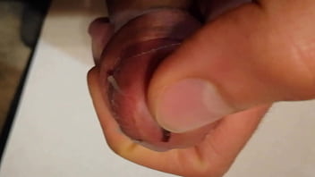 peehole stretcher cum