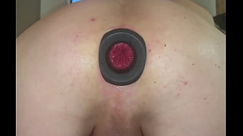 ussy ring gape